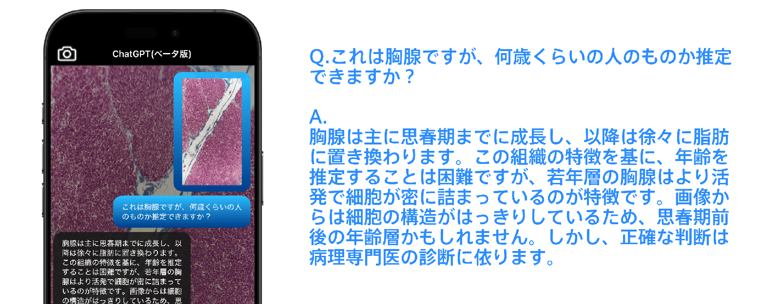 胸腺の画像から年齢の推定を質問したAIチャット画面